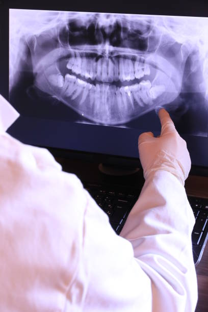 Best Broken or Cracked Tooth Emergency Dentist in Hayfork, CA