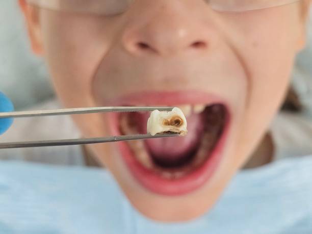 Best Pediatric Emergency Dentist in Hayfork, CA